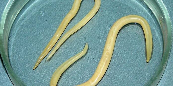 Glisty ludzkie na szalce Petriego - pasożytują na ściankach jelita cienkiego