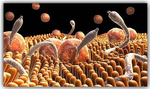 pasożyty w organizmie